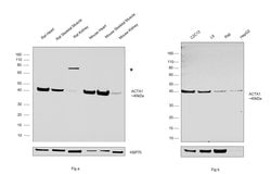 Invitrogen ACTA1 Polyclonal Antibody 100 &mu;L; Unconjugated:Antibodies