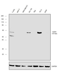 Invitrogen EGR1 Polyclonal Antibody 100 &mu;L | Buy Online | Invitrogen&trade; | Fisher Scientific