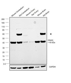 Invitrogen GNAQ Polyclonal Antibody 100 &mu;L; Unconjugated:Antibodies,