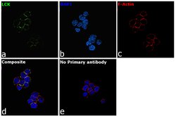 Invitrogen LCK Polyclonal Antibody 100 &mu;L; Unconjugated:Antibodies,