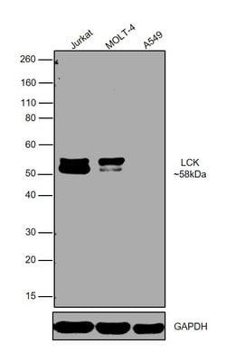 Invitrogen LCK Polyclonal Antibody 100 &mu;L; Unconjugated:Antibodies,