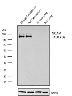 Invitrogen CD56 (NCAM) Polyclonal Antibody 100 &mu;L | Buy Online | Invitrogen&trade; | Fisher Scientific