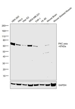 Invitrogen PKC zeta Polyclonal Antibody 100 &mu;L | Buy Online | Invitrogen&trade; | Fisher Scientific