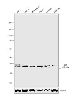 Invitrogen SET Polyclonal Antibody 100 &mu;L; Unconjugated:Antibodies,