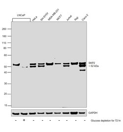 Invitrogen SKP2 Polyclonal Antibody 100 &mu;L; Unconjugated:Antibodies,
