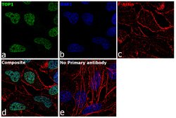 Invitrogen TOP1 Polyclonal Antibody 100 &mu;L; Unconjugated:Antibodies,