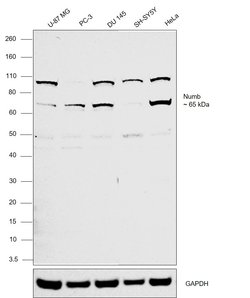 Invitrogen NUMB Polyclonal Antibody 100 &mu;L | Buy Online | Invitrogen&trade; | Fisher Scientific