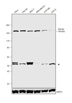 Invitrogen ROCK2 Polyclonal Antibody 100 &mu;L; Unconjugated:Antibodies,