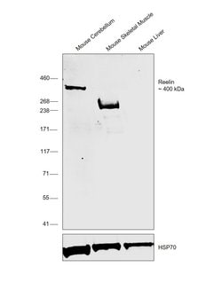 Invitrogen Reelin Polyclonal Antibody 100 &mu;L | Buy Online | Invitrogen&trade; | Fisher Scientific