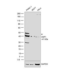 Invitrogen VMP1 Polyclonal Antibody 100 &mu;L; Unconjugated:Antibodies,