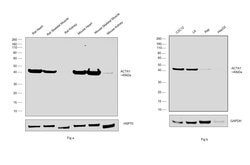 Invitrogen ACTA1 Polyclonal Antibody 100 &mu;g; Unconjugated:Antibodies,