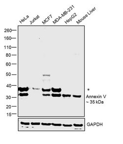 Invitrogen Annexin V Polyclonal Antibody 100 &mu;g | Buy Online | Invitrogen&trade; | Fisher Scientific