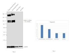 Invitrogen SERCA1 ATPase Polyclonal Antibody 100 &mu;g; Unconjugated:Antibodies,