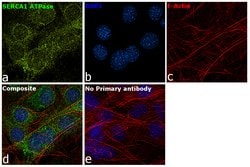 Invitrogen SERCA1 ATPase Polyclonal Antibody 100 &mu;g; Unconjugated:Antibodies,