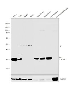 Invitrogen Carbonic Anhydrase II Polyclonal Antibody 100 &mu;g; Unconjugated:Antibodies,