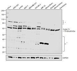 Invitrogen Cyclin T1 Polyclonal Antibody 100 &mu;g; Unconjugated:Antibodies,