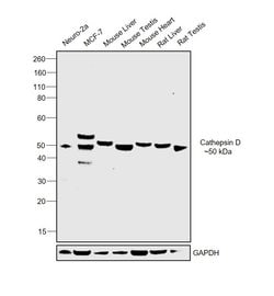 Invitrogen Cathepsin D Polyclonal Antibody 100 &mu;g | Buy Online | Invitrogen&trade; | Fisher Scientific