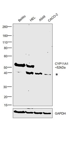Invitrogen CYP11A1 Polyclonal Antibody 100 &mu;g; Unconjugated:Antibodies,