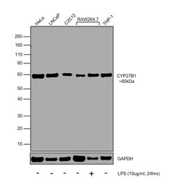 CYP27B1 Polyclonal Antibody:Antibodies, Polyclonal