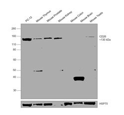 Invitrogen CD26 Polyclonal Antibody 100 &mu;g | Buy Online | Invitrogen&trade; | Fisher Scientific