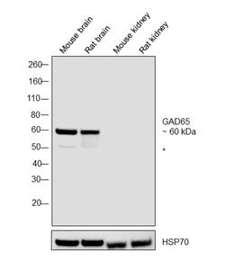 Invitrogen GAD65 Polyclonal Antibody 100 &mu;g; Unconjugated:Antibodies,