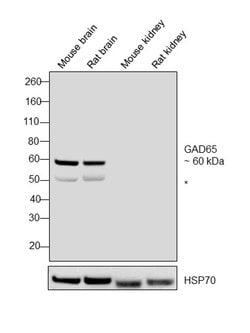 Invitrogen GAD65 Polyclonal Antibody 100 &mu;g; Unconjugated:Antibodies,