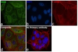 Invitrogen GAS6 Polyclonal Antibody 100 &mu;g; Unconjugated:Antibodies