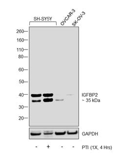 Invitrogen IGFBP2 Polyclonal Antibody 100 &mu;g; Unconjugated:Antibodies,
