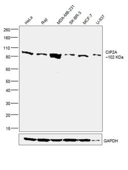 Invitrogen CIP2A Polyclonal Antibody 100 μg; Unconjugated:Antibodies,