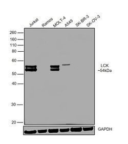 Invitrogen LCK Polyclonal Antibody 100 &mu;g; Unconjugated:Antibodies,