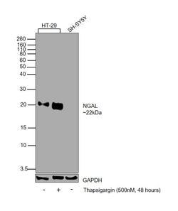Invitrogen NGAL Polyclonal Antibody 100 &mu;g | Buy Online | Invitrogen&trade; | Fisher Scientific