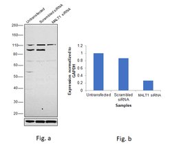 Invitrogen MALT1 Polyclonal Antibody 100 &mu;g; Unconjugated:Antibodies,
