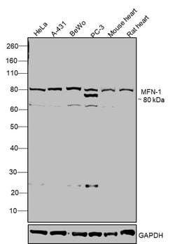 Invitrogen MFN1 Polyclonal Antibody 100 &mu;g | Buy Online | Invitrogen&trade; | Fisher Scientific