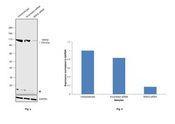 Invitrogen MSH2 Polyclonal Antibody 100 &mu;g; Unconjugated:Antibodies,