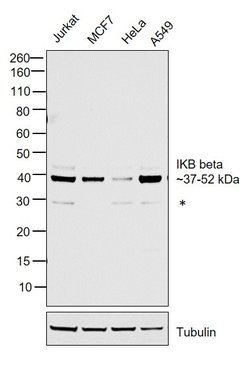 Invitrogen IkB beta Polyclonal Antibody 100 &mu;g; Unconjugated:Antibodies,