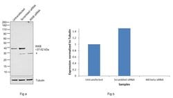Invitrogen IkB beta Polyclonal Antibody 100 &mu;g; Unconjugated:Antibodies,
