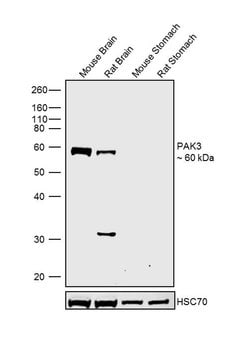 Invitrogen PAK3 Polyclonal Antibody 100 &mu;g; Unconjugated:Antibodies,