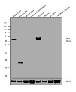 Invitrogen PKLR Polyclonal Antibody 100 &mu;g; Unconjugated:Antibodies,