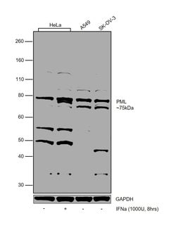 Invitrogen PML Polyclonal Antibody 100 &mu;g | Buy Online | Invitrogen&trade; | Fisher Scientific