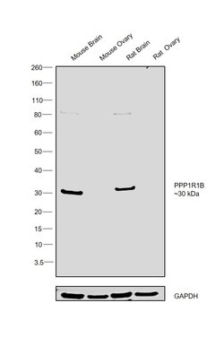 Invitrogen DARPP-32 Polyclonal Antibody 100 &mu;g; Unconjugated:Antibodies,