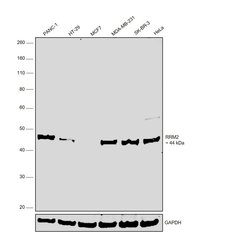 Invitrogen RRM2 Polyclonal Antibody 100 &mu;g; Unconjugated:Antibodies,