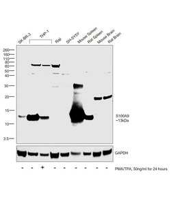 Invitrogen S100A9 Polyclonal Antibody 100 &mu;g; Unconjugated:Antibodies,