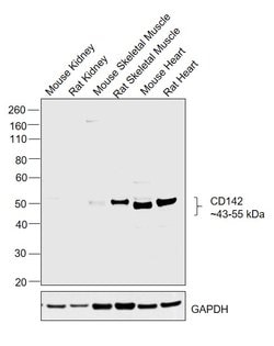 Alpha Sarcoglycan Polyclonal Antibody:Antibodies, Polyclonal