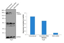 Invitrogen SMC3 Polyclonal Antibody 100 &mu;g; Unconjugated:Antibodies,