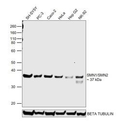 Invitrogen SMN1/SMN2 Polyclonal Antibody 100 &mu;g | Buy Online | Invitrogen&trade; | Fisher Scientific