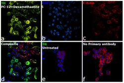 Invitrogen&trade;&nbsp;Tyrosine Hydroxylase Polyclonal Antibody