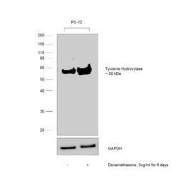 Invitrogen Tyrosine Hydroxylase Polyclonal Antibody 100 &mu;g | Buy Online | Invitrogen&trade; | Fisher Scientific