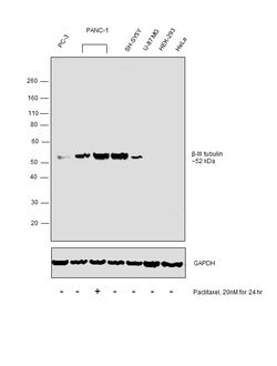 Invitrogen beta-5 Tubulin Polyclonal Antibody 100 &mu;g; Unconjugated:Antibodies,