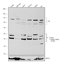 Invitrogen PTPN2 Polyclonal Antibody 100 &mu;L; Unconjugated:Antibodies,