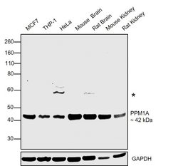 Invitrogen PPM1A Polyclonal Antibody 100 &mu;L; Unconjugated:Antibodies,